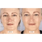 currentbody-led-light-mask