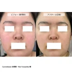 currentbody-led-light-mask